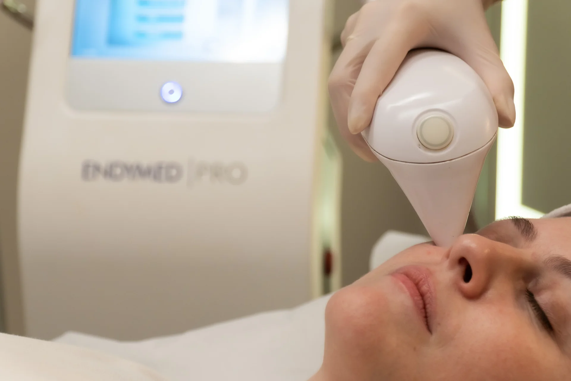 Tecnologia iFine - Estímulo preciso de colágeno para flacidez palpebral e rejuvenescimento do olhar. Avaliação dermatológica em Uberlândia.